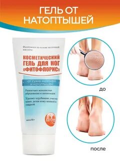 Средства от натоптышей на ступнях эффективные