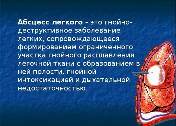 Гнойные абсцессы легких. Абсцесс легкого гнойное расплавление. Абсцесс легкого кратко. Гнойное расплавление лёгочной ткани.