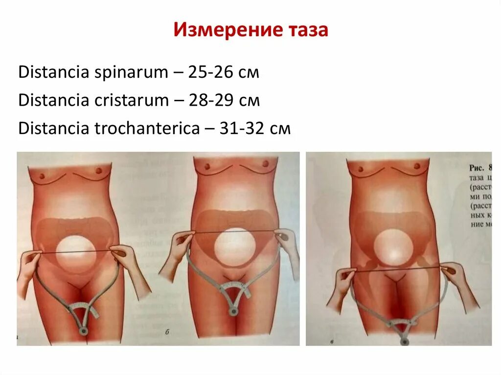 Алгоритм таз. Размеры таза в акушерстве измерение. измерения таза беременной в акушерстве. таблица методика измерения женского таза. измерение таза беременной пельвиометрия.