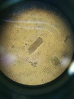 Моча в микроскоп ImmunoCap.ru