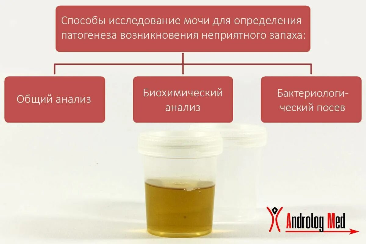 Капает моча у мужчин. Моча пахнет аммиаком. Мутная моча с запахом аммиака. Темная моча и неприятный запах. Резко темная моча.