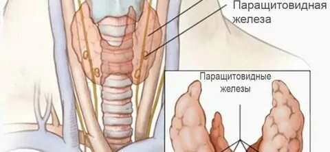 Операция на паращитовидной железе