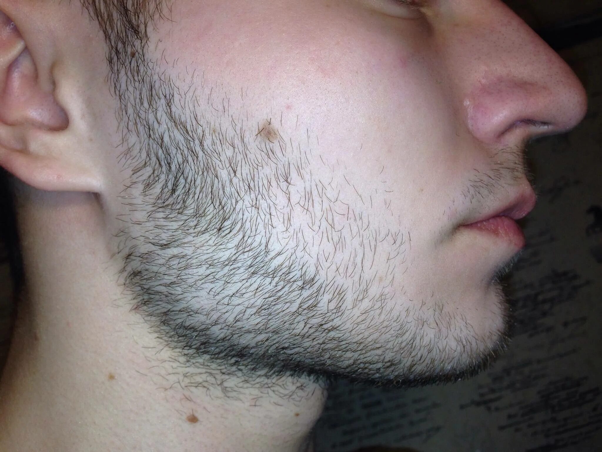 Рост волос на лице у мужчин. Редкая борода миноксидил. Щетина на лице. Однодневная щетина.