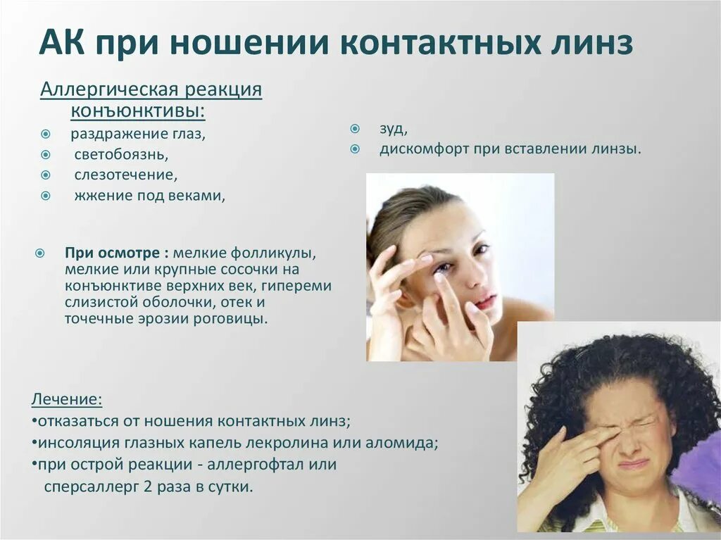 Линзы при конъюнктивите. Контактные линзы последствия. Линзы для коррекции миопии. Контактные линзы для глаз. Осложнение контактные линзы.