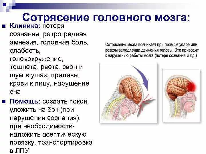 Сотрясение при ударе. Диагностические критерии сотрясения головного мозга. Три основных признака при сотрясении головного мозга.. Сотрясение ГМ симптомы. Длительность потери сознания при сотрясении головного мозга.