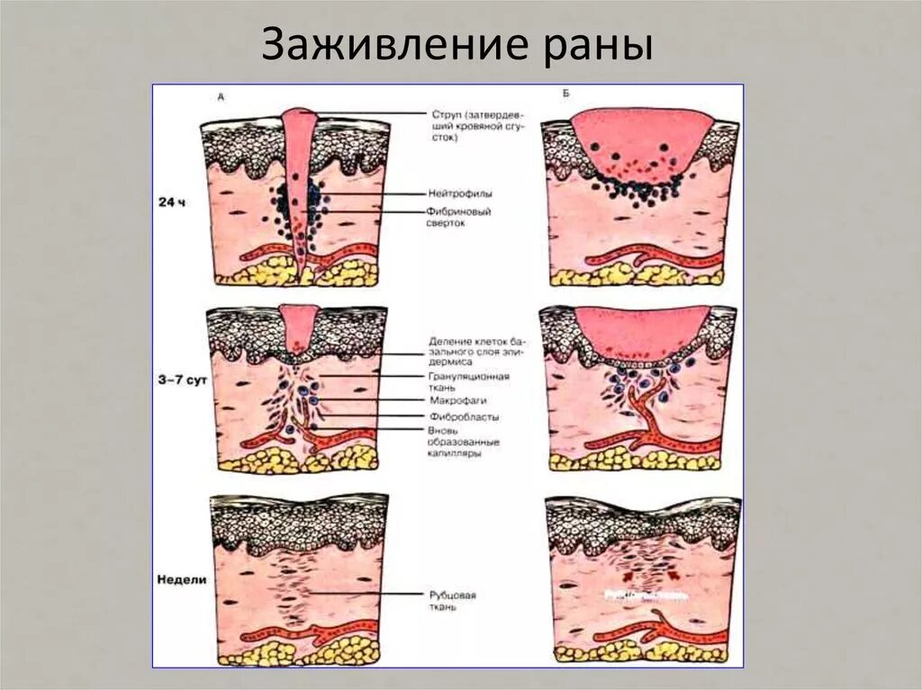 Виды повреждений ткани