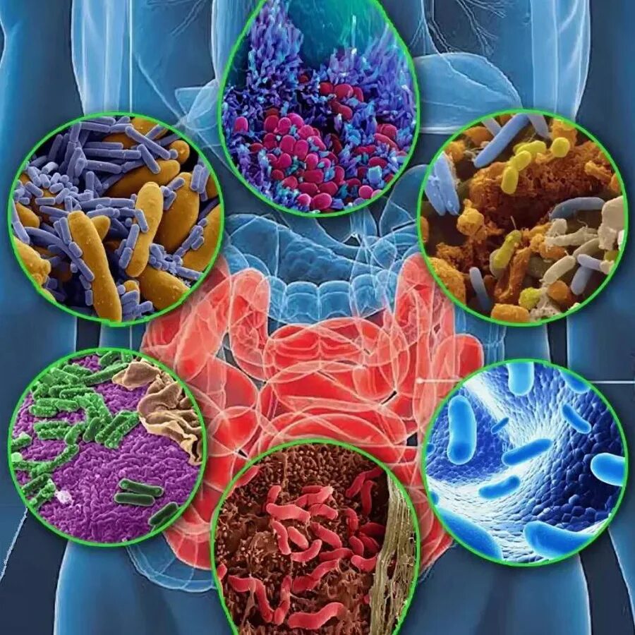Роль бактерий толстого кишечника человека. Микробиом (микробиота). Микробиом это в микробиологии. Микрофлора микробиом микробиота. Дисбактериоз кишечника бактерии.