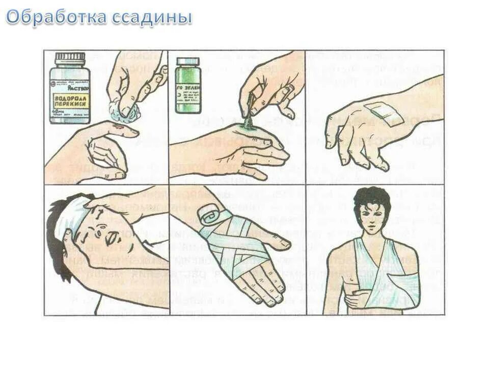 Туалет ран алгоритм. Оказание первой медицинской помощи при ссадинах. обработка раны при оказании первой помощи.