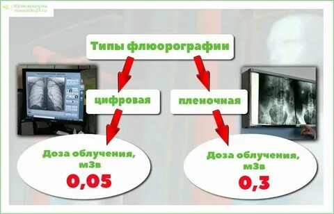 Флюорография на ранних сроках беременности до задержки