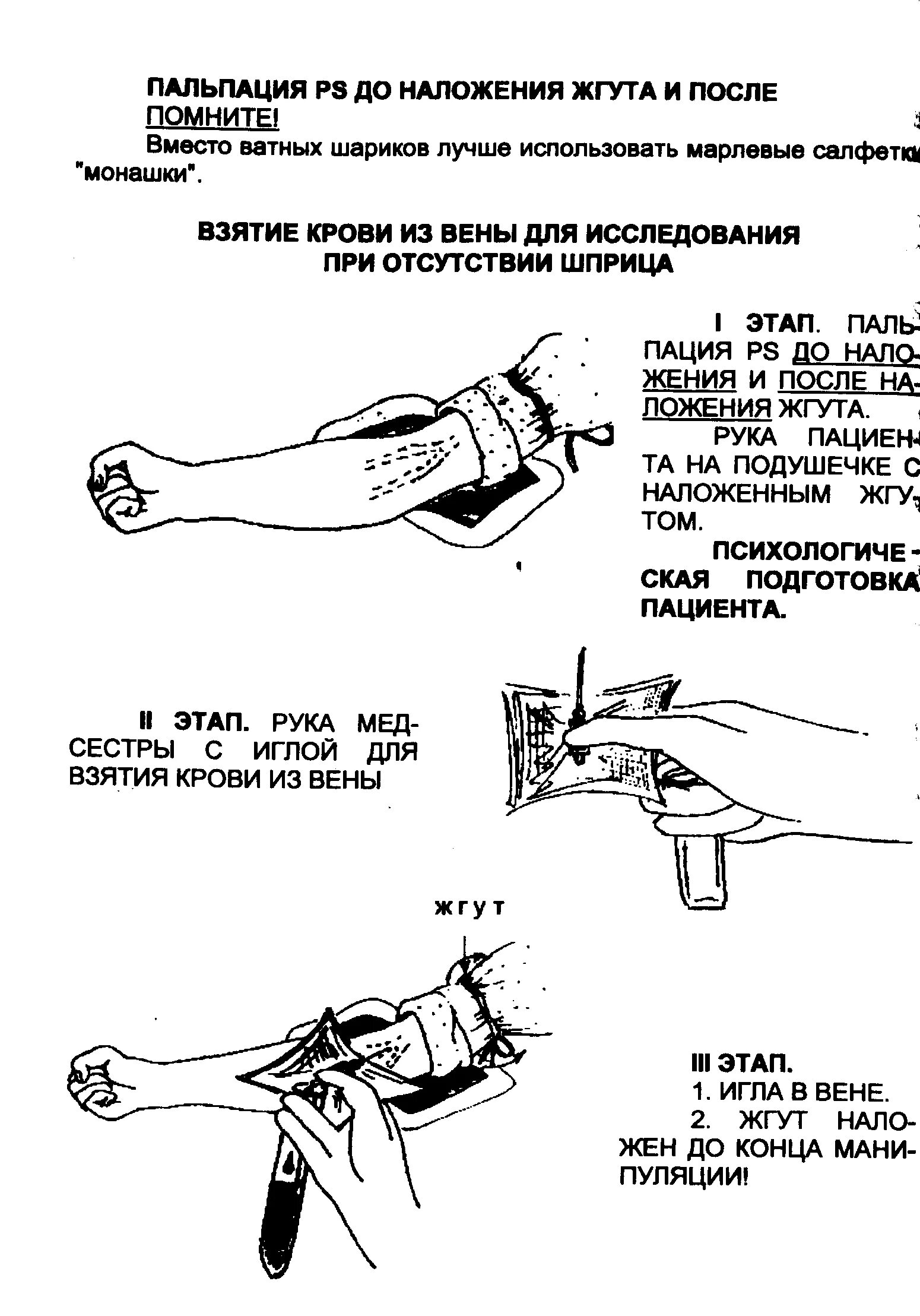 Манипуляция взятие. Алгоритм взятия крови кровь из вены. Алгоритм взятие крови из вены вакуумной системой. Взятие крови из периферической вены алгоритм. Алгоритм техники забора крови из вены.