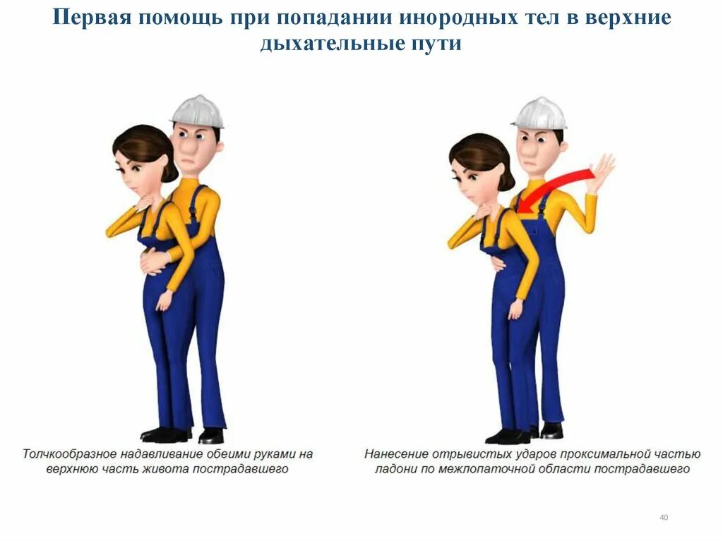 Неотложная помощь при попадании инородного тела. Первая помощь при попадании инородных тел в верхние дыхательные. первая помощь при попадании инородного тела в дыхательные пути. первая помощь при попадание инородных тел в верхней дыхателтные пути. оказание первой помощи при попадании инородного тела в дыхательные.