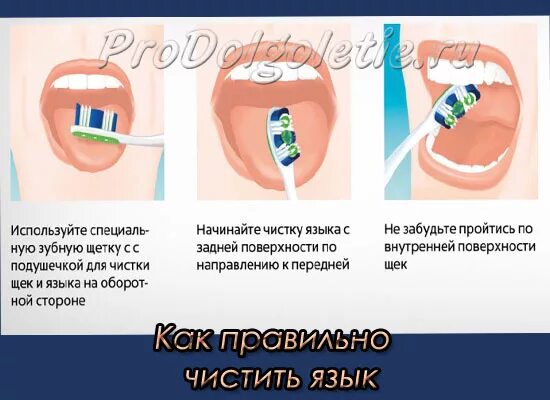 После чистки языка. Правильная чистка языка. Чистка языка зубной щеткой. Чистка языка от налета.