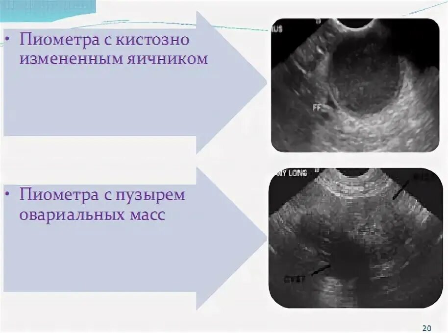 Кистозная дегенерация яичников УЗИ. Кистозные изменения яичника УЗИ. Кистозно измененный яичник УЗИ.