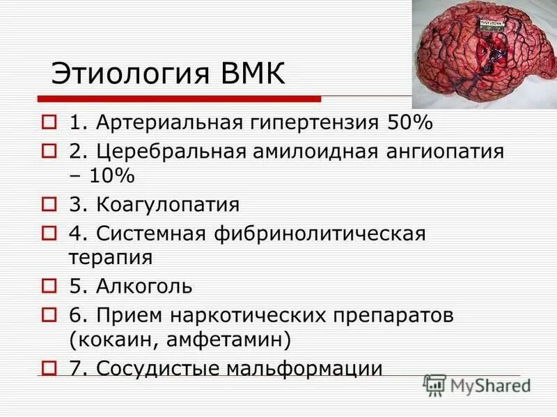 патогенез геморрагического инсульта схема. кровоизлияние этиология. субарахноидальное кровоизлияние патогенез. патогенез острого нарушения мозгового кровообращения. кровоизлияние этиология.
