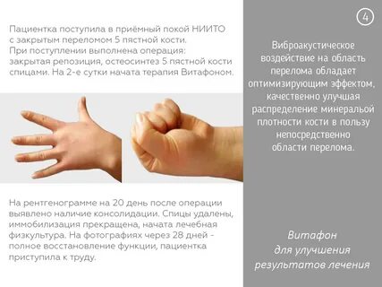 Улучшить результатов лечения