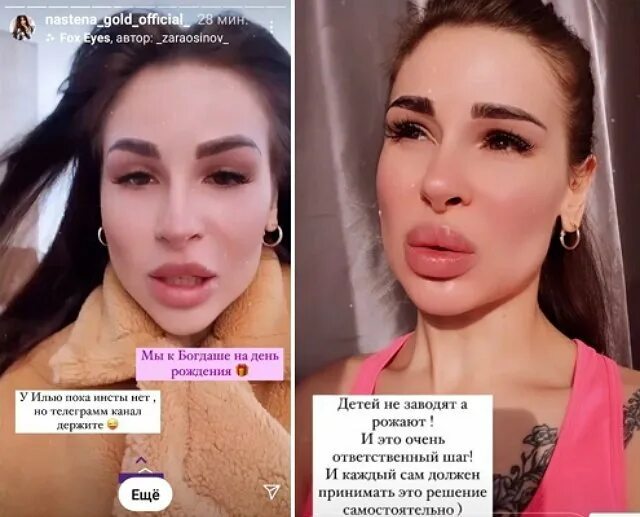 Илье Яббарову пришлось самому обратиться к подписчикам из-за тяжелейшего состоян