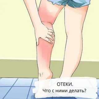 Сильные отеки перед месячными