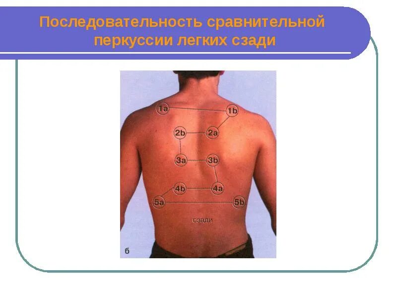 Сравнительная и топографическая перкуссия легких. Сравнительная перкуссия легких алгоритм пропедевтика. сравнительная перкуссия грудной клетки пропедевтика.