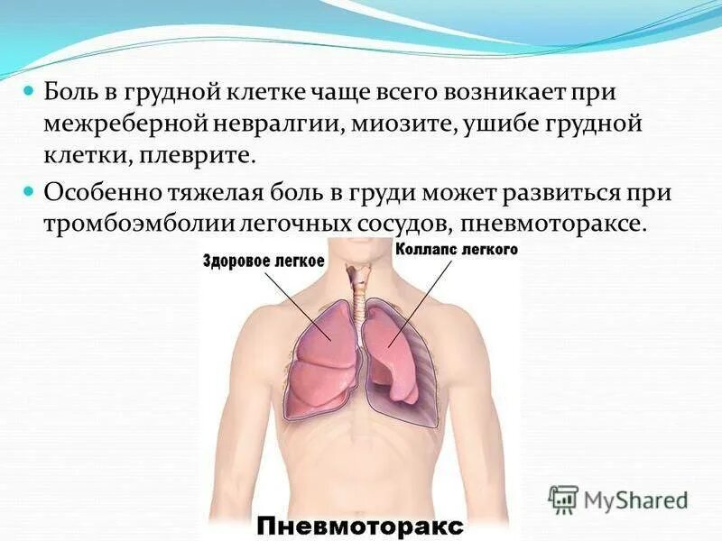 Дискомфорт в середине грудной клетки. Ломота в грудной клетке посередине. Ноющие боли в грудной клетке. Покалывание левого легкого