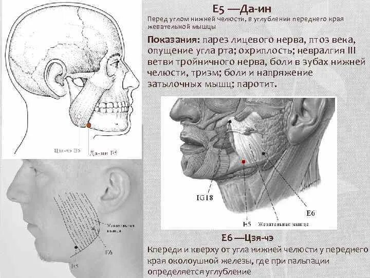 Передний край жевательной мышцы. Передним краем жевательной мышцы. Болит угол нижней челюсти. Передние края жевательных мышц.