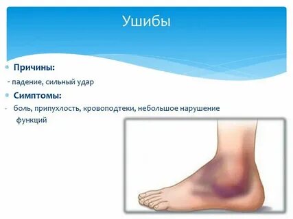 Признаки ушиба конечности