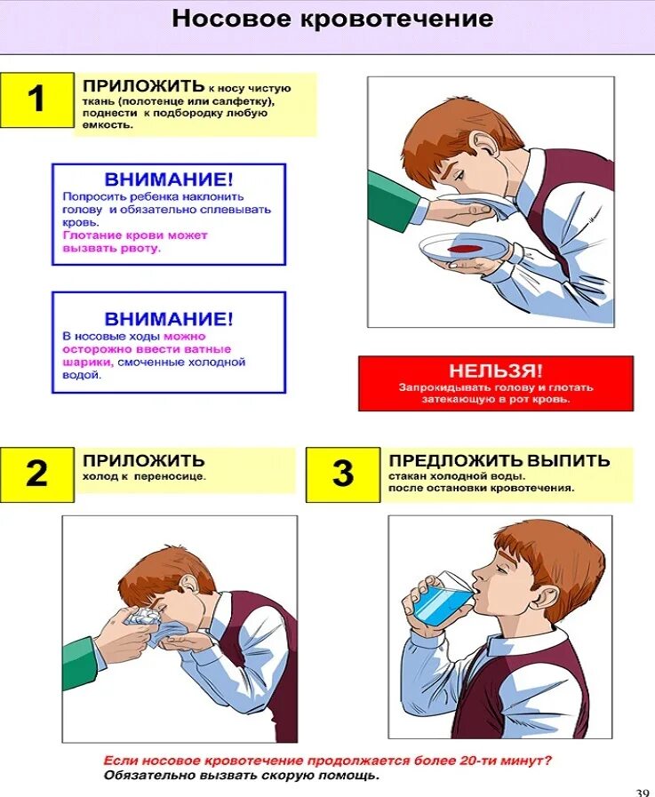 Остановить кровотечение из носа. Остановить носовое кровотечение у ребенка. Акае Остановить кровь из носа. Какостанововить носовое кровотечение. Ребенок 7 лет идет кровь из носа
