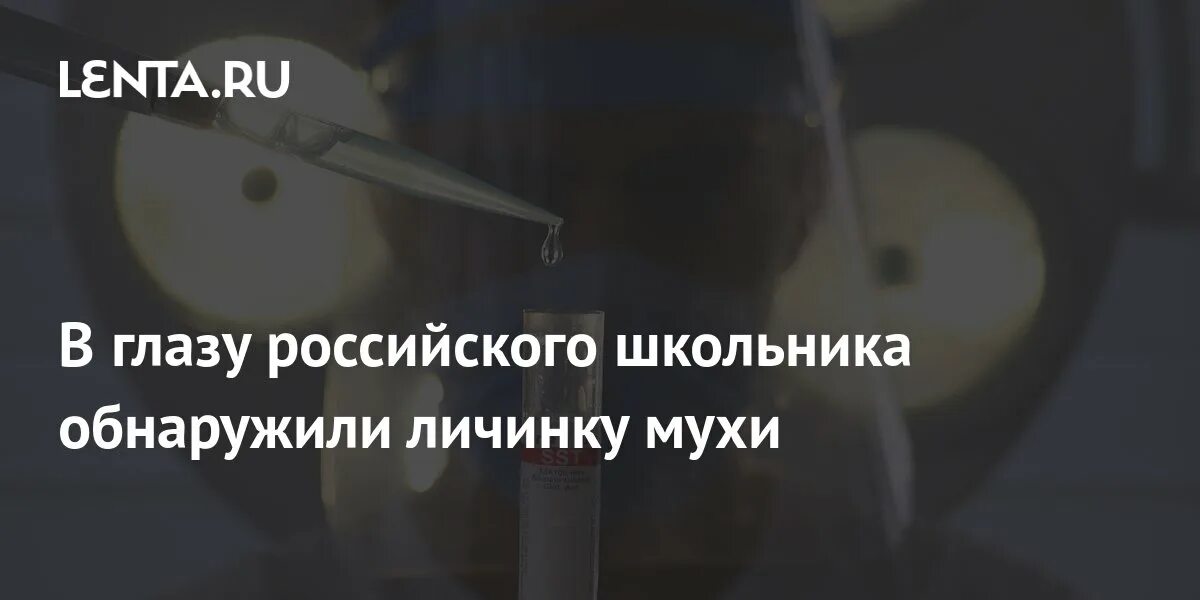 Машина насекомое. Мошка залетела в глаз приметы. Мошка залетела в глаз приметы. Муха на окне. Мушки перед глазами.