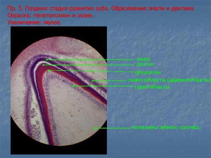 Стадии развития зуба. Гистогенез зуба гистология. Дентин препарат гистология. Гистогенез зуба образование дентина и эмали. Ранняя стадия развития зуба гистология.