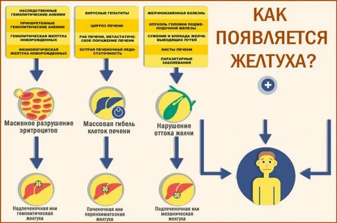 Начальная стадия желтухи. Желтуха у взрослых симптомы. Желтуха симптомы у детей