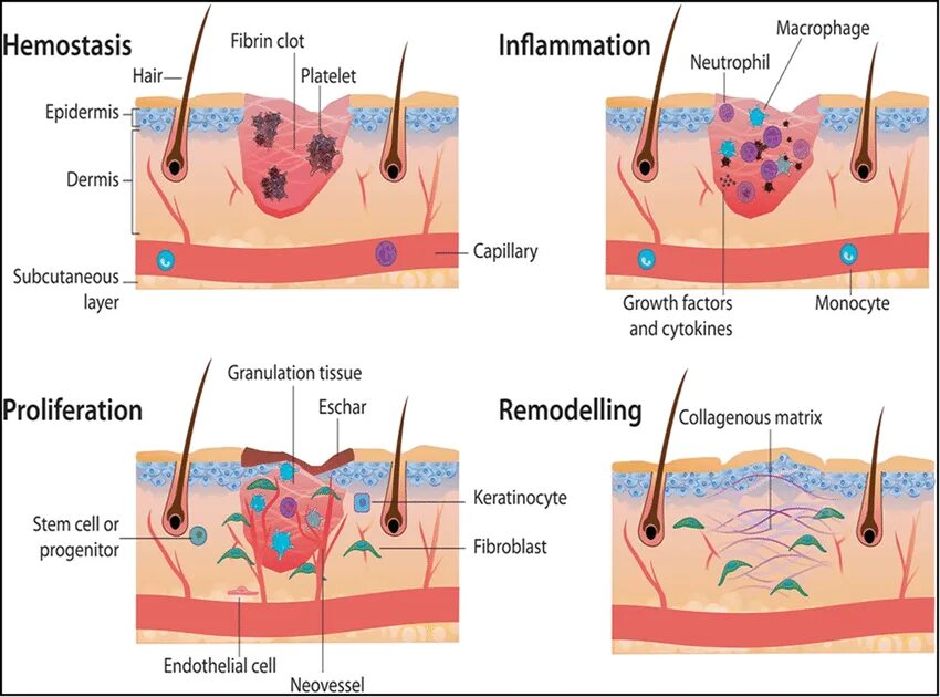 What is a wound. What is a wound
