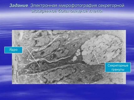 Электронная микрофотография