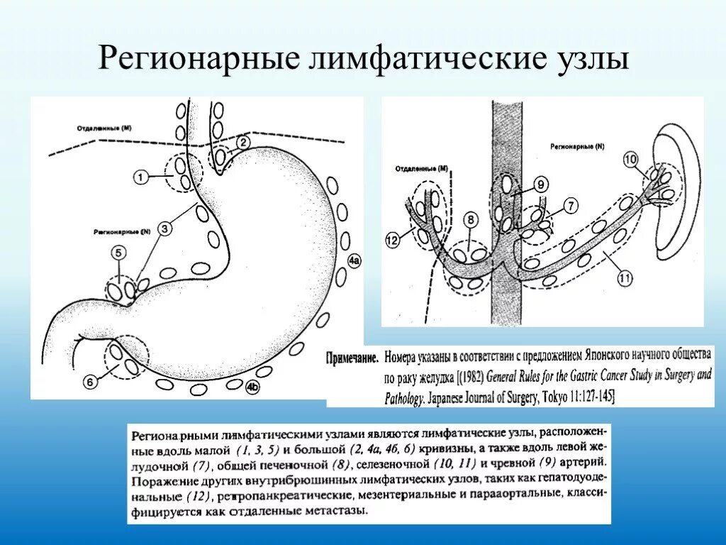 Операция лимфатические узлы. Схема регионарных лимфатических узлов желудка. Регионарные лимфоузлы желудка анатомия. Регионарные лимфатические узлы тонкого кишечника. Лимфатические узлы желудка на кт.