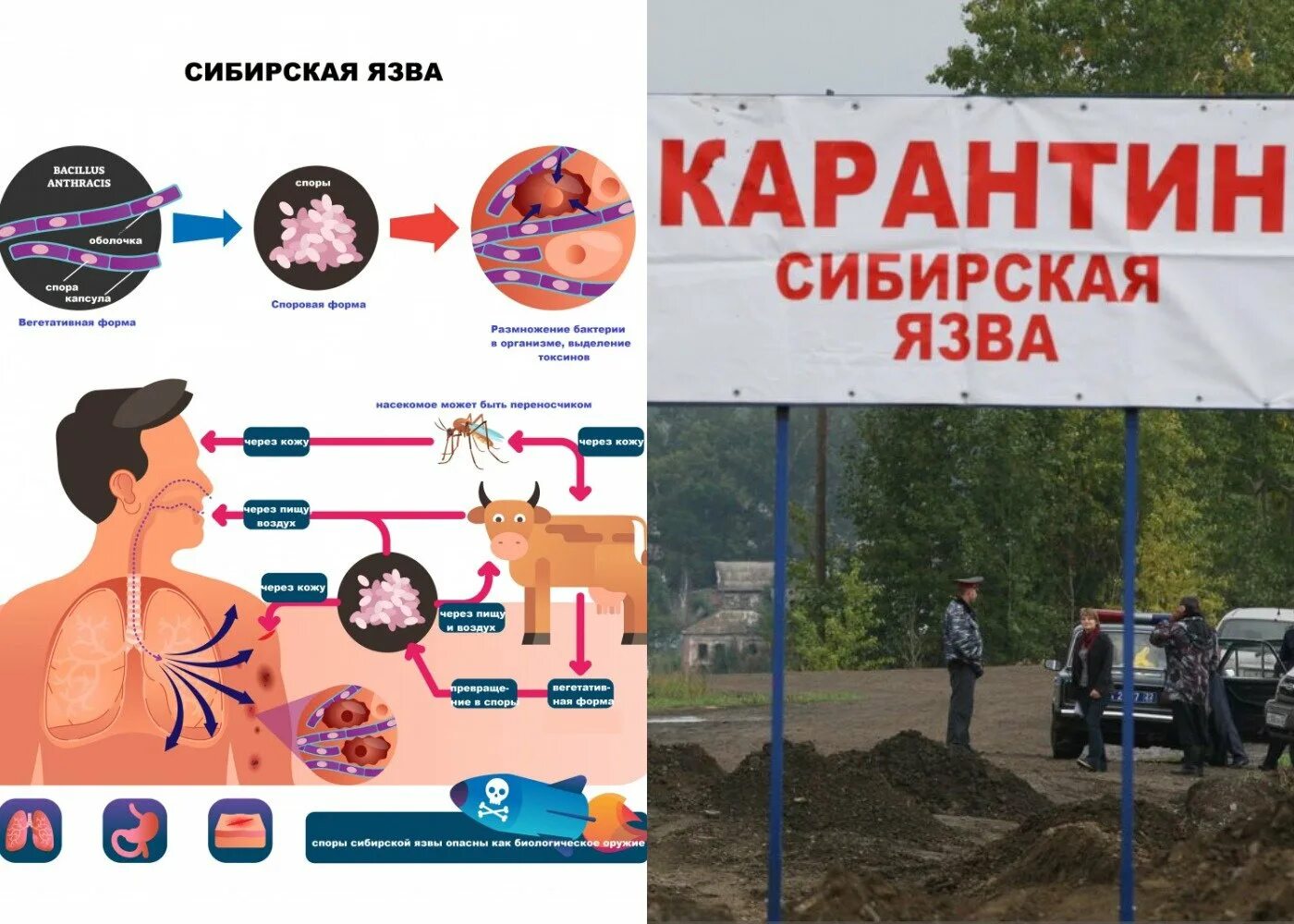 Неспецифическая профилактика сибирской язвы. Возбудитель сибирской язвы, bacillus anthracis. Профилактика сибирской язвы. Bacillus anthracis сибирская язва. Препарат сибирская язва.