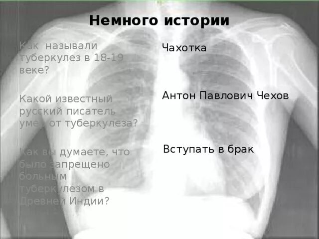 Как называли туберкулез