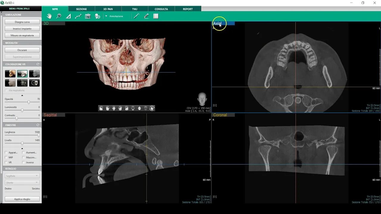 VATECH ez3d-i. Ez3d Plus. Программа ez3d Plus. Ez3d2009