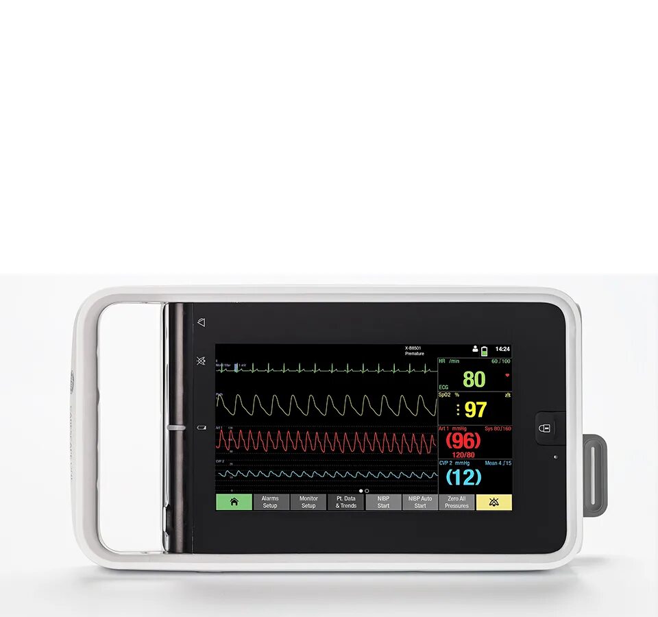 Monitoring 1