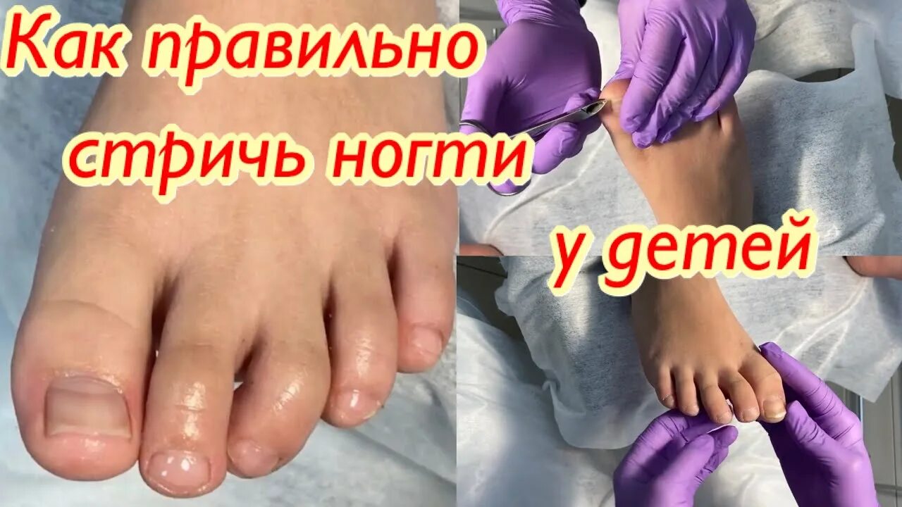 Подстричь ногти в страстную пятницу. Как правильно стричь ногти на ногах ребенку. как правильно стричь ногти на ногах. как подстричь вросший ноготь. как правильно стричь ногти ребенку.