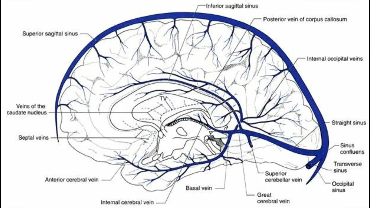 Вены головного мозга. Синусы головного мозга схема кт. Синусы головного мозга схема мрт. Синусы головного мозга анатомия кт. Венозные синусы головного мозга схема животных.