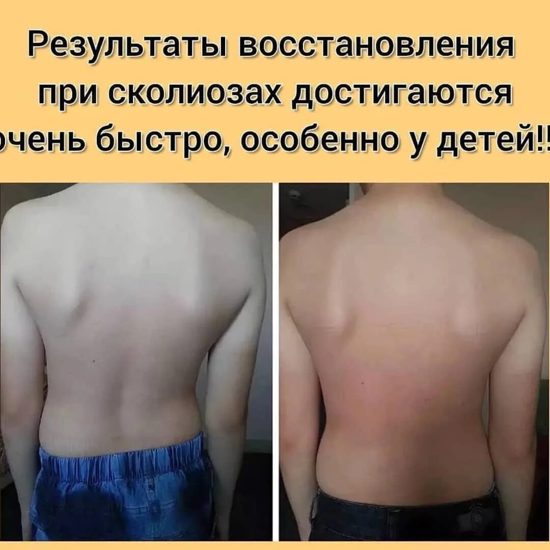 Можно ли исправить деформацию