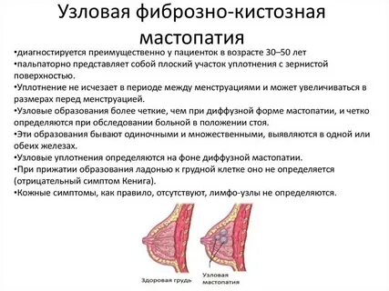 Морфологические признаки молочной железы