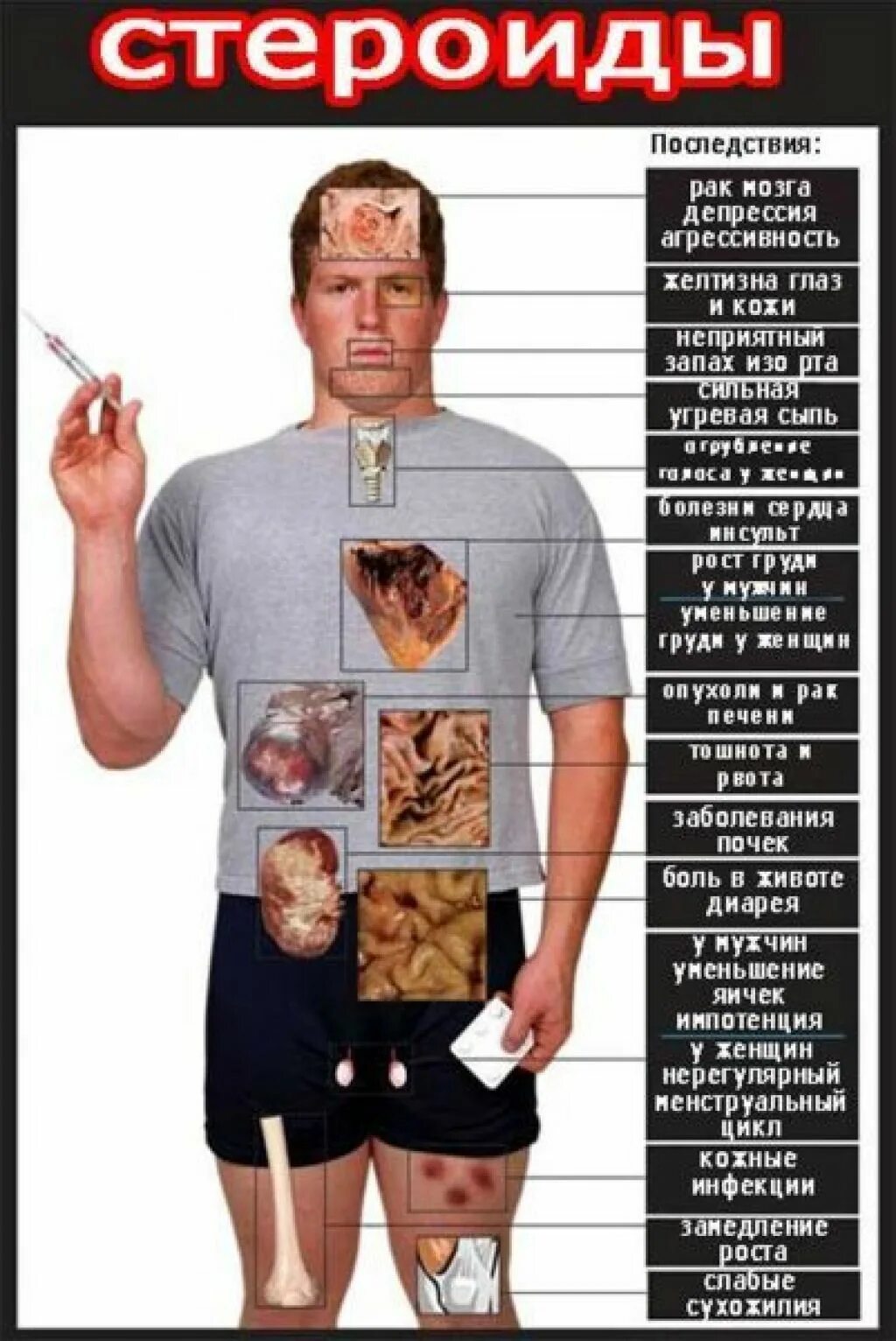 Стероиды побояныетэфекты. Стероиды побочные эффекты. Побочные метана