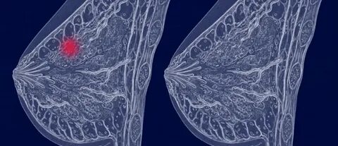 Көпшіліктің ішінен транни