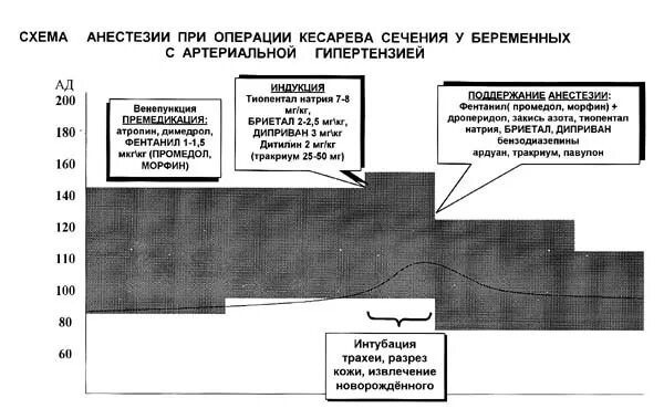 Лучший наркоз при кесаревом сечении. Схема обезболивания. протокол анестезиологического пособия при кесаревом сечении. эпидуральная анестезия фентанилом. анестезия при кесаревом сечении.