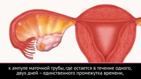 Трубы матки