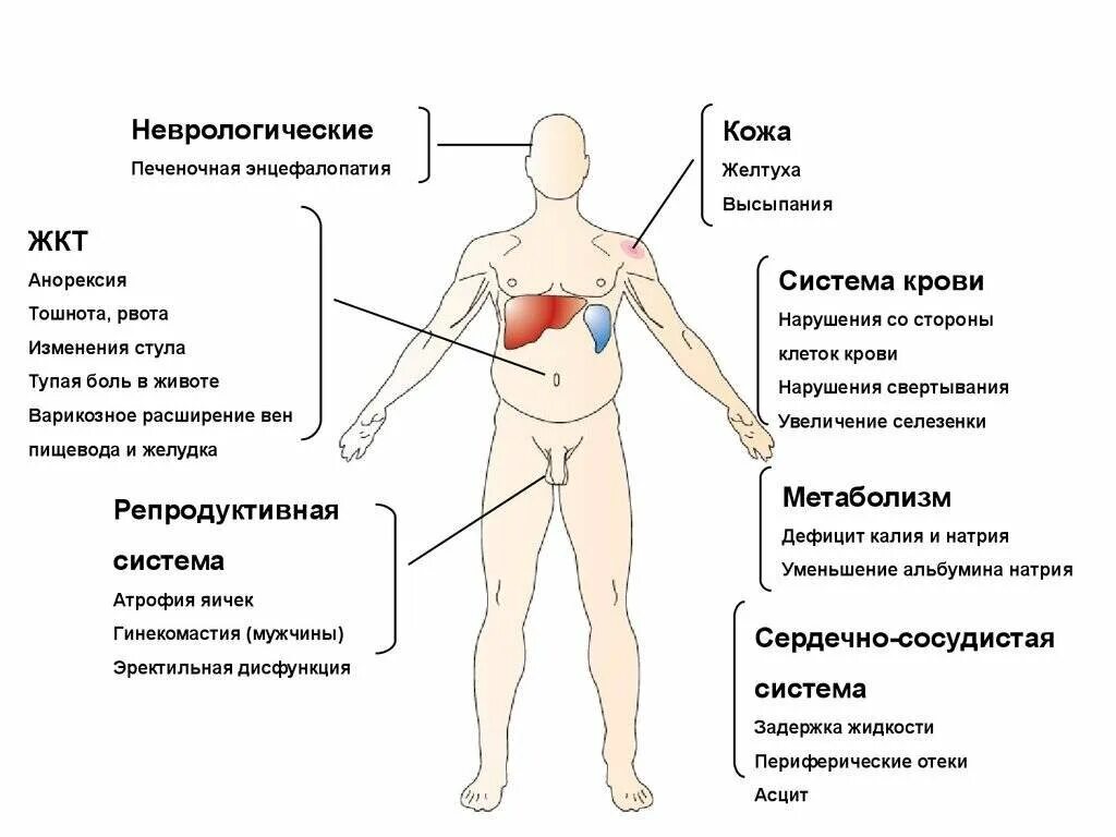 Как проявляется гепатит с у мужчин. Гепатит с симптомы у мужчин первые. гепатит симптомы у мужчин. внешние проявления гепатита с.