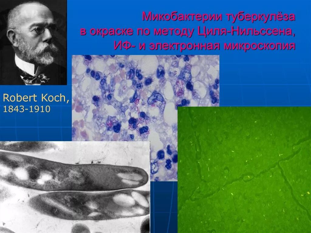 Микобактерия туберкулеза. Электронная микроскопия туберкулеза. Окраска микобактерий туберкулеза. Mycobacterium tuberculosis метод окраски.