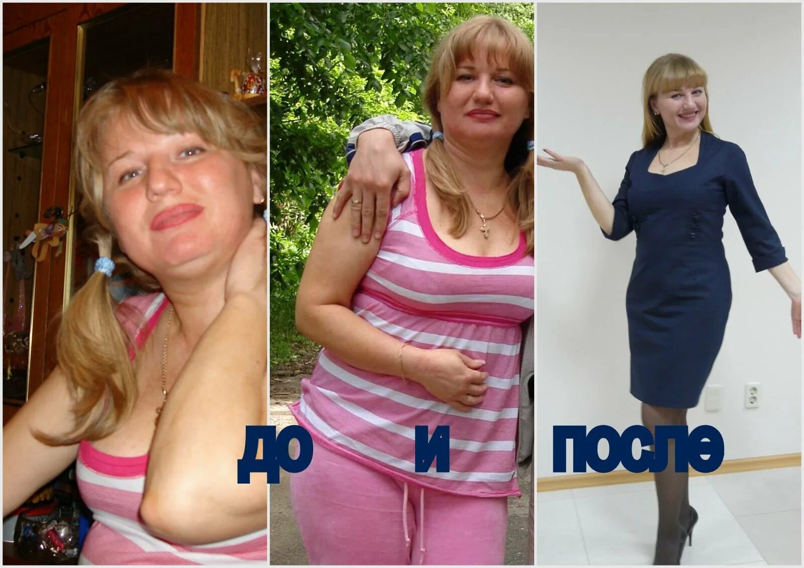 Отзывы фото до и после. Похудение на редуксине до и после. Результат похудения с редуксином. Похудение с редуксином 15. Редуксин до и после.
