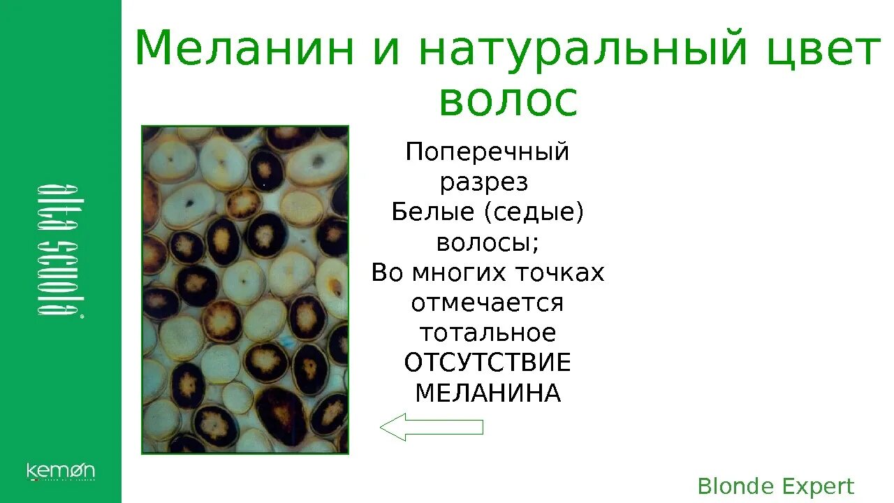 Меланин цвет волос. Типы пигментов эумеланин. Меланин цвет волос. Структура седых волос. Пигменты меланина в волосах.
