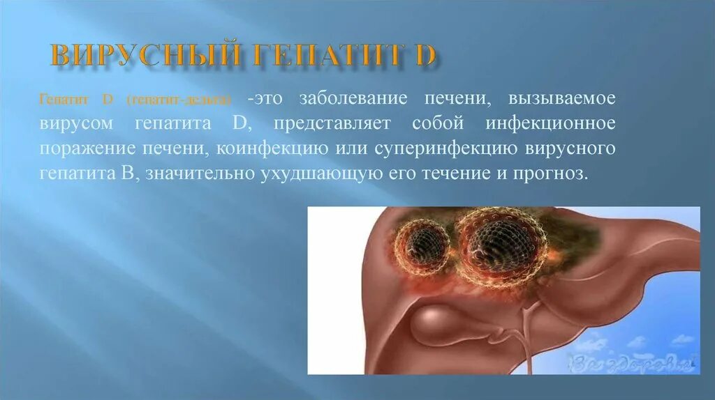 Гепатит в мире. Гепатит Дельта симптомы. Гепатит Дельта осложнения. Гепатит д вирусное заболевание печени.