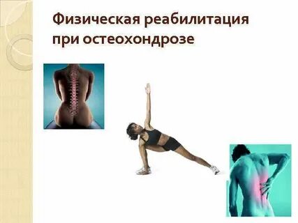 Реабилитация при остеохондрозе
